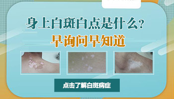 白癜风症状和后果